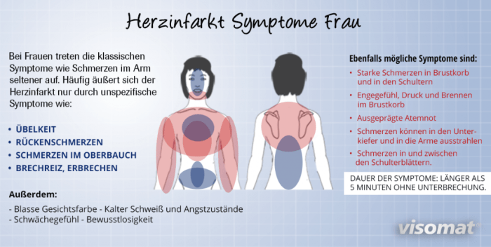 Herzinfarkt myokardinfarkt symptome ursachen typ herzkranzgefäße kommt therapie verschluss ablagerungen wänden spricht