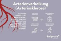 Arteriosklerose: Symptome, Ursachen, Behandlung und Vorbeugung