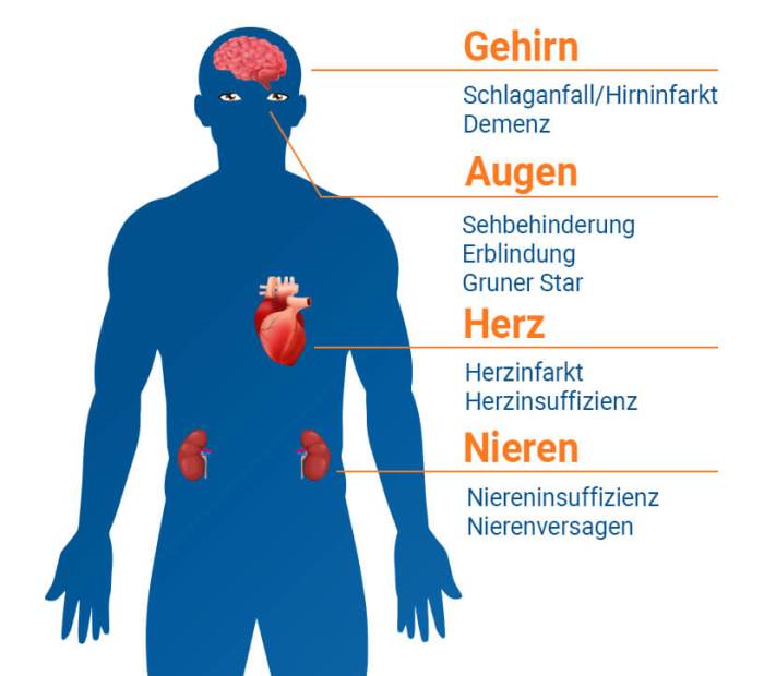 Ursachen bluthochdruck hypertonie risikofaktoren primäre